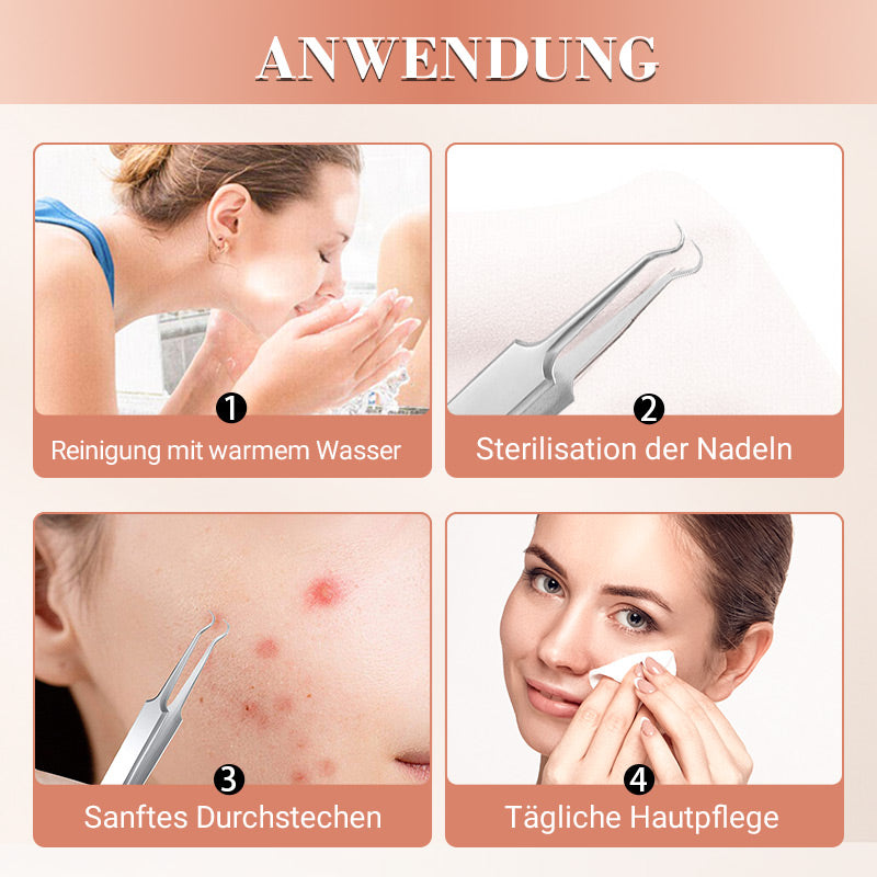 ⚡ 50% RABATT! ✨ EDELSTAHL-MITESSERENTFERNER - 7-teiliges Set für Tiefenreinigung, Präzisionswerkzeuge für Gesichtspflege, Sterilisierbar und Hautschonend 🌟🧴