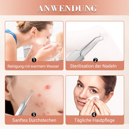 ⚡ 50% RABATT! ✨ EDELSTAHL-MITESSERENTFERNER - 7-teiliges Set für Tiefenreinigung, Präzisionswerkzeuge für Gesichtspflege, Sterilisierbar und Hautschonend 🌟🧴
