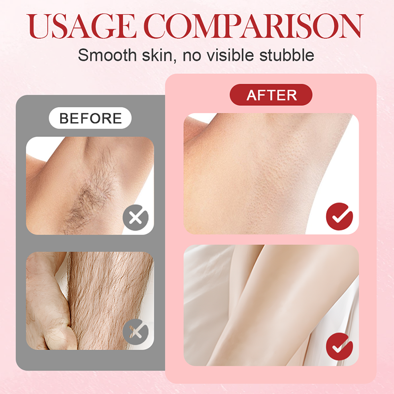 👑 Tragbarer Elektrischer Dual-Kopf Epilierer ✨⚡