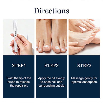 ✨Neuheiten🔥Feder zur Behandlung von Nagelpilz bei beschädigten Nägeln