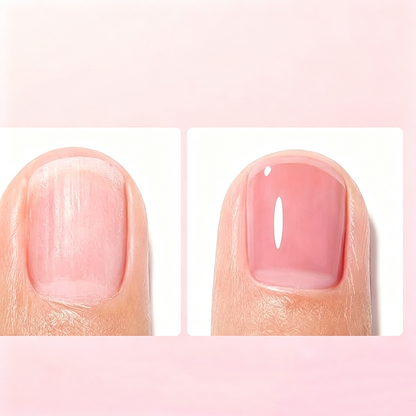 📢📢Heiße Aktion: 1+1 GRATIS!⏰ Professioneller Nagelhärter mit Milchprotein – intensive Pflege, stärkere Nägel und ein gesunder, natürlicher Glanz ✨